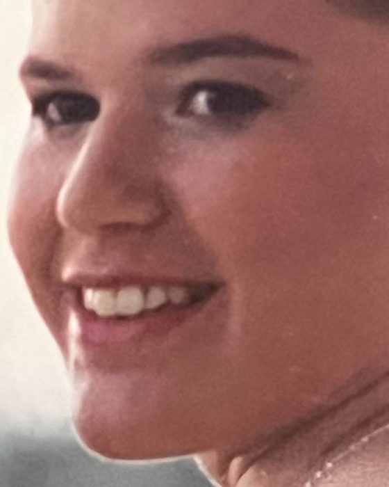 A close-up of a natural-looking smile restored with dental bonding