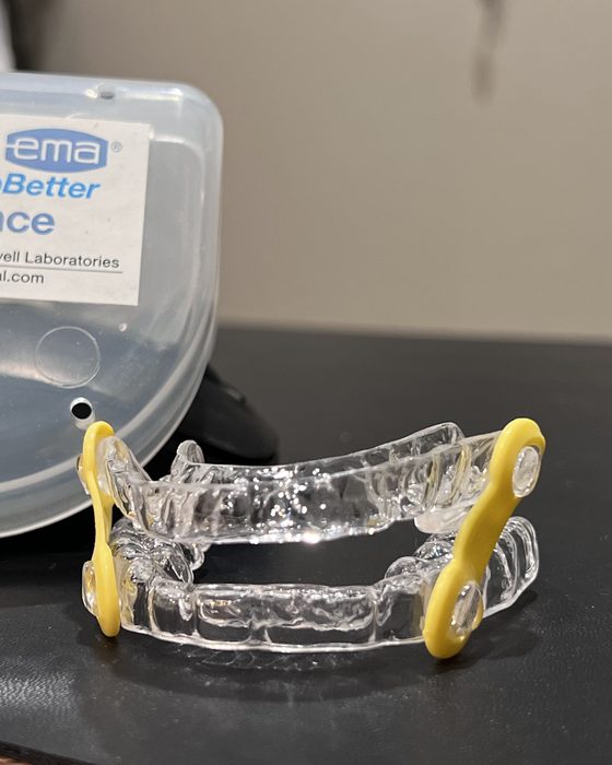 A custom oral appliance for sleep apnea in its case