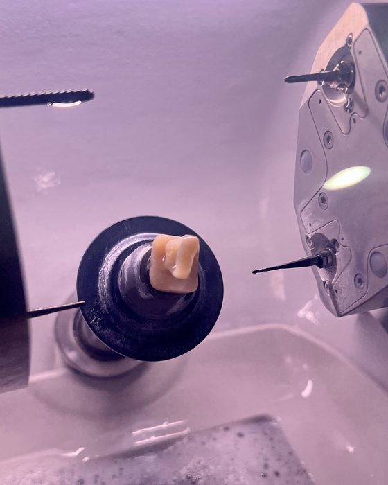 The chairside milling unit cutting a ceramic crown during a same-day crown appointment